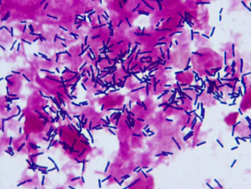 疾控中心微生物检测实验室显微镜应用