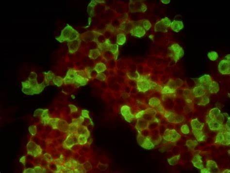 疾控中心病毒实验室的显微镜应用