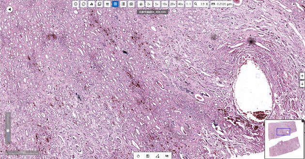 疾控中心病理学实验室的显微镜应用