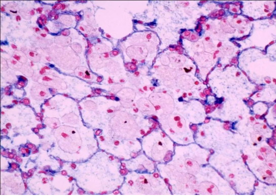 疾控中心职业卫生实验室的显微镜应用